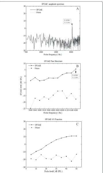 Figure 4 SFOAE test results for one participant at a CF of 4 kHz. (A) SFOAE amplitude spectrum.(B) SFOAE fine structure