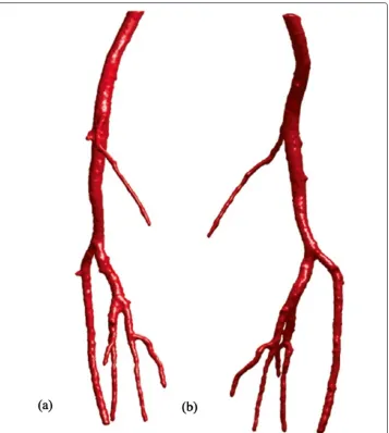 Figure 7 3D vascular tree of the segmentation result on peripheral artery CTA dataset using theproposed localized hybrid technique