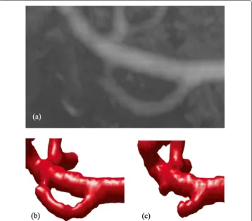 Figure 9 Detailed comparison of the segmentation of thin vessels in low contrast situations