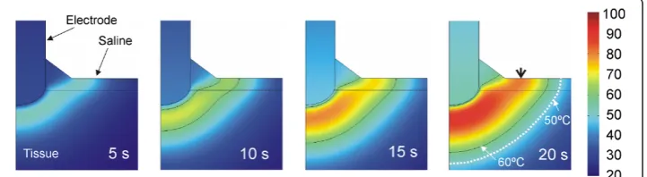 Figure 6, we analyzed in detail the electrical variables involved in the RF power applica-In order to gain a better understanding of the temperature distributions shown inand Specific Absorption Rate (SAR) at the start of heating (at 1 second)