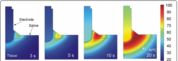 Figure 7 Spatial distribution of the electrical variables. Electric field (E), current density (J) and SpecificAbsorption Rate (SAR) at the beginning of the RF heating (after 1 second).