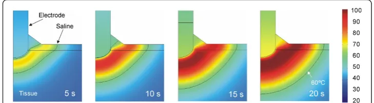 Figure 9 Evolution of the temperature distributions in the case of in vivo situation. Evolution of thetemperature distributions (scale in °C) during RF heating considering an in vivo setting, i.e