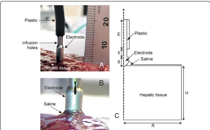 Figure 1 Physical situation and theoretical model. A: Physical situation with the electrode placedperpendicular to the tissue surface before saline infusion