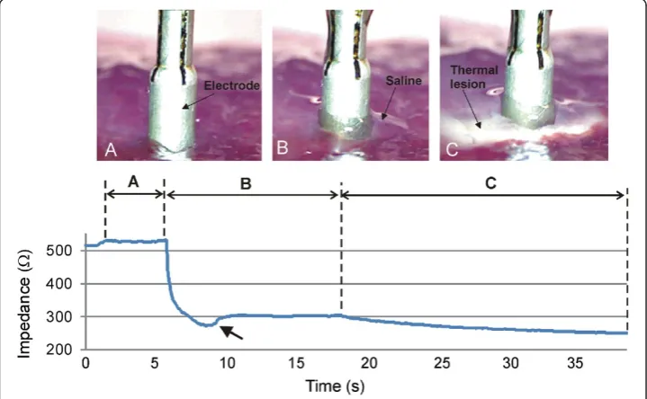 Figure 3 Impedance progress throughout the experiments. Three phases can be observed: A)Electrode placed on tissue surface without saline infusion