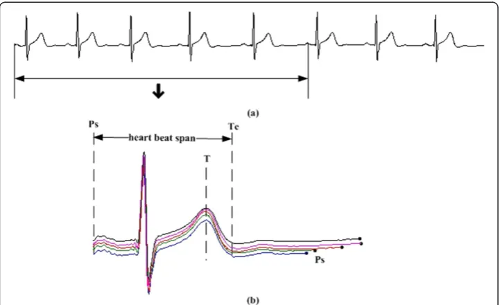 Figure 1 A complete cardiac cycle and some feature points.