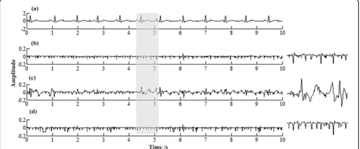 Table 2 WPRs using PRR, RR and LP for 20 synthetic aECGs