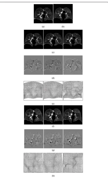 Figure 8 Registration of lung slices. (a) and (b) are the source and target images, they are slices withmaximum inhale and maximum exhale phases respectively