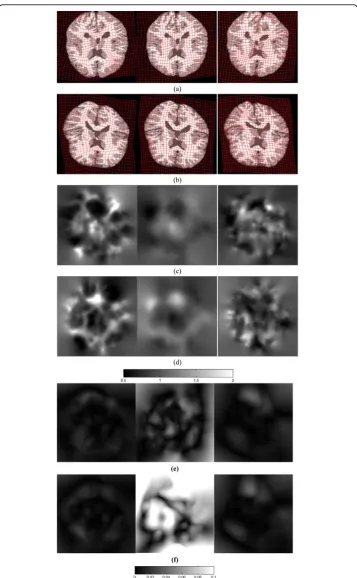 Figure 10 Individual brain slice registration exampleregistered results for subject 5 and 6 using the MCRPM, CRPM, and RPM