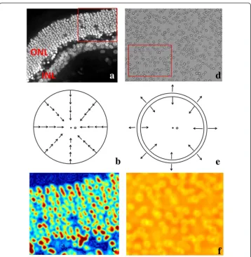 Figure 5 Comparison of gradient vector distribution and SBF filter enhancement results betweenthe dark field and bright field