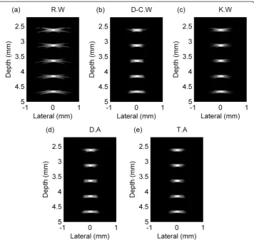 Figure 4 Point target simulation results of the singular window functions and dual-/tri-apodization.window functions, andPoint target simulation results of (a) rectangular window function (R.W), (b) Dolph-Chebyshev window function(D-C.W), (c) Kaiser window function (K.W), (d) dual-apodization (D.A) using rectangular and Dolph-Chebyshev (e) tri-apodization (T.A) using rectangular, Dolph-Chebyshev, and Kaiser window functions.