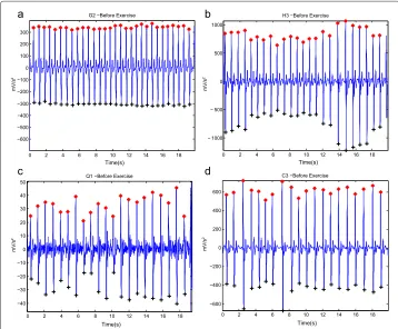 Figure 8(b). Moreover, the proposed algorithm was also able to detect a waves correctlyin low amplitude APG signals (small voltage), as shown in Figure 7(c), and after 2 hours