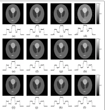 Table 4 PSNRs (dB) of the noise simulation image