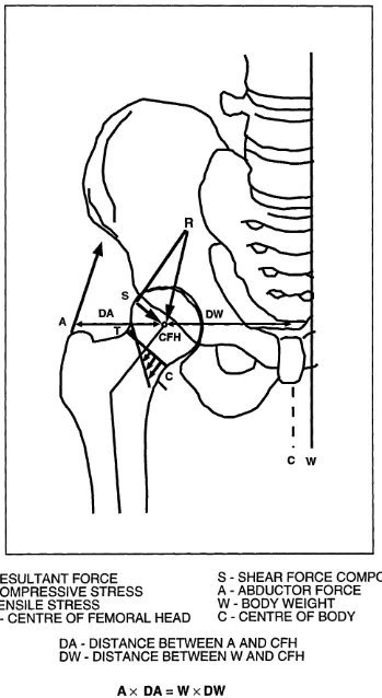 FIG. 3.1 FORCES ACTING ACROSS THE HIP JOINT IN A SINGLE-LEGGED STANCE, DRAWN AS A "FREE BODY "