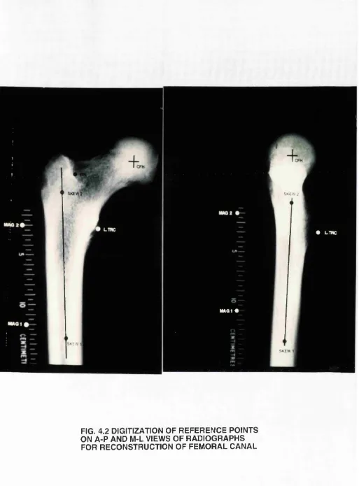 FIG. 4.2 DIGITIZATION OF REFERENCE POINTS ON A-P AND M-L VIEWS OF RADIOGRAPHS 