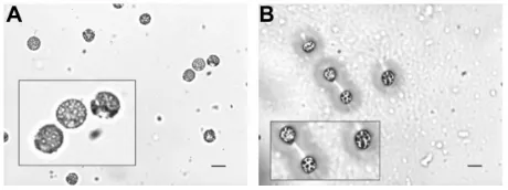 Figure 5 Representative microscopic spore shapes seen following in vitro acid digestion and zinc sulfate flotation.Notes: (A) spiked (reticulate) spore shape associated with species of Cortinarius violaceus, Lactarius, Lycoperdon perlatum, and Russula