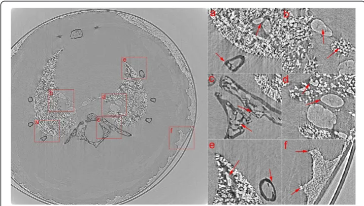 Figure 7 Reconstructed CT slice from a mouse lung by FBP with the proposed geometric correctionmethod