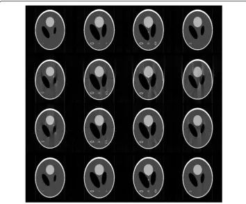 Figure 5 Four CT slice images of modified 3D Shepp-Logan phantom reconstructed by FBP
