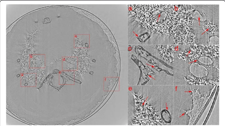 Figure 6 Reconstructed CT slice from a mouse lung by FBP with MC-based sinogram correctionmethod