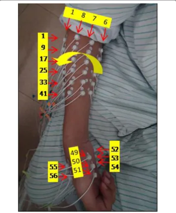 Figure 2 Electrode placement in the experiments.