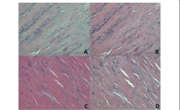 Figure 2 Color normalization. Original image (A) and (C); Normalized results (B) and (D), respectively.