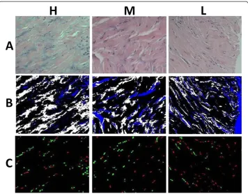 Figure 3 Results in different steps of processing. (A) The normalized images of the three pathologicalgrades
