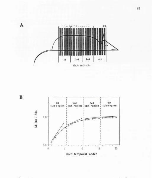 Figure 4.6. (A) The total number of slices divided into 4 sub-sets when the slices arecomponent of 280 ms Ti (Ts=25 ms, TE=30 ms, and T selected in their spatial order