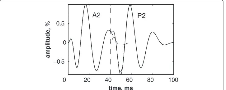 Table 1 The A2–P2 valvular split detected by the RSPWVD–based detection method