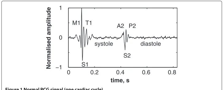 Figure 2 Simulated aortic (A2) valvular chirp.