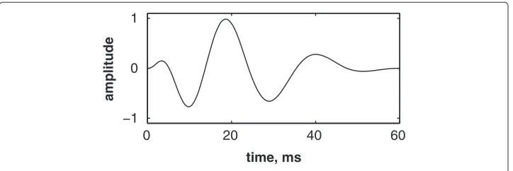 Figure 3 Simulated pulmonic (P2) valvular chirp.