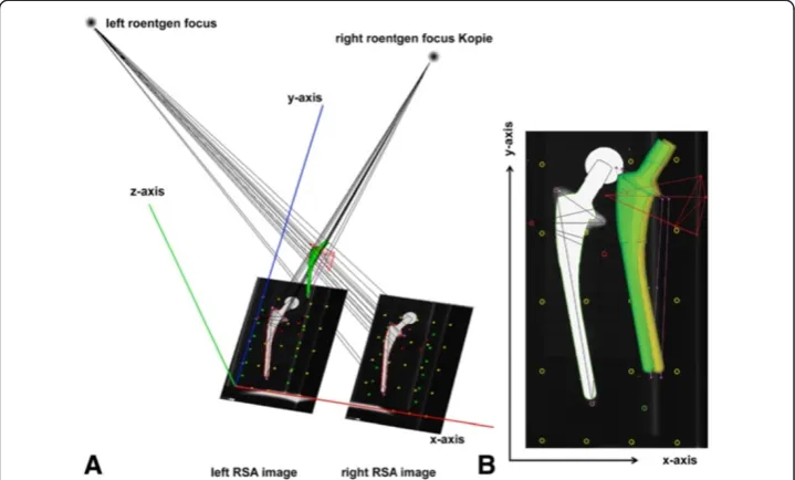 Figure 1 Reference RSA radiograph. A) Migration is represented with respect to a global fiducialcoordinate system defined relative to the calibration box translation along the medio-lateral (x-axis, red)and superior-inferior (y-axis, blue) axes constitute 