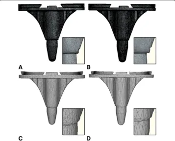 Figure 4 RE surface model. Surface model of a tibial total knee arthroplasty component generated withRE technology