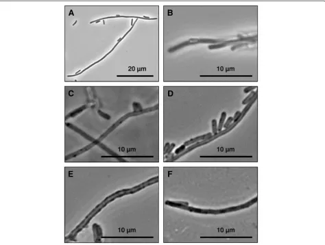 Figure 1 Light microscope images of filamentouscoated polyelectrolyte capsules are shown in imagepalladium particles and image E