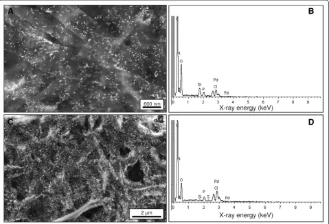 Figure 3 SEM images of filamentous polyelectrolyte capsules. Polyelectrolyte capsules without additional S-layer polymer protein with palladiumparticles are shown in (A) and with additional S-layer polymer protein with palladium particles are shown in (C)