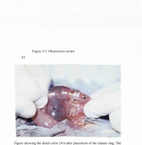 Figure showing the distal colon 24 h after placement of the silastic ring. The proximal bowel is dilated more than faeces in the lumen, 2x the normal diameter and the distal bowel is collapsed