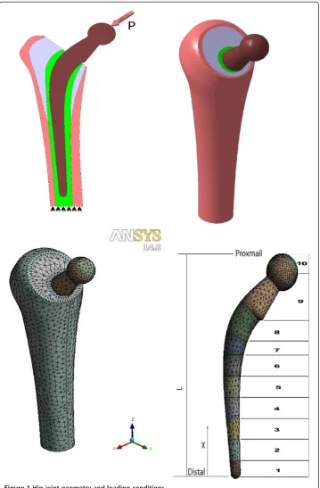 Figure 1 Hip joint geometry and loading conditions.