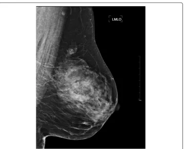 Figure 4 ROIs containing micro-calcifications. Totally eight ROIs were selected, and every ROI included anumber of micro-calcifications with varied shape, size and distribution.