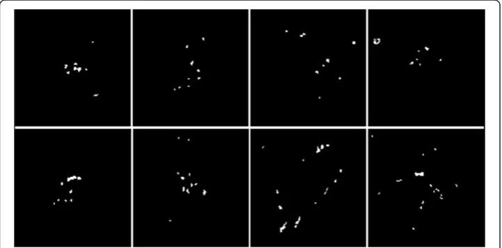 Figure 5 Results of micro-calcifications detection. Micro-calcifications corresponding to Figure 3 weredetected effectively.