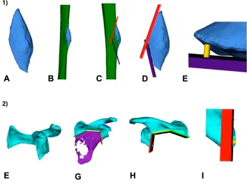 Figure 2 Postoperative analysis. First row (1): The accuracy analysis was performed based on the resection specimen