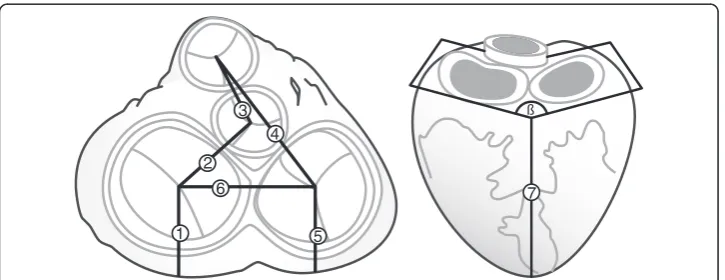 Figure 2 Investigated valve parameters (based on figure three in [10]).