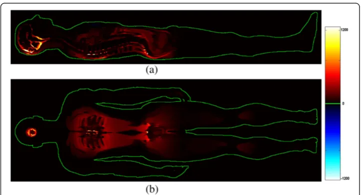 Figure 3 Sagittal (a) and coronal (b) sections of the patient representing the difference betweenthe two current densities (A/m2) (with and without conductive table)