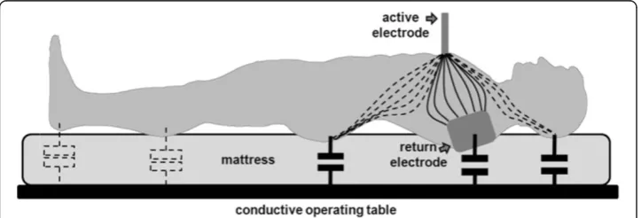 Figure 4 Qualitative illustration of current distribution inside patient’s body and capacitivecoupling with a conductive operating table