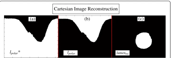 Figure 9 Cartesian image reconstruction. (a) lpolar* the complementary part of the polar lumen objectreconstructed