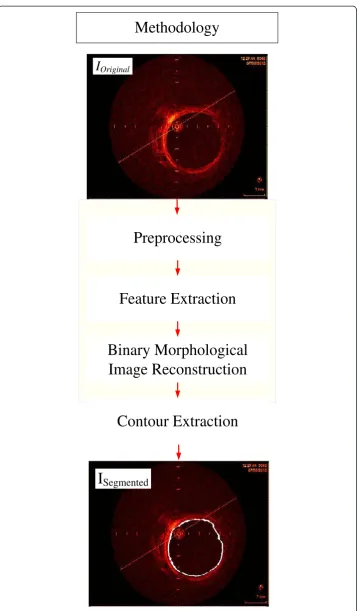 Figure 1 Block diagram of the major parts of the segmentation process.