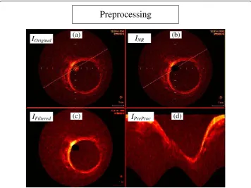 Figure 2 Steps of the preprocessing stage. (a) Original image. (b) Original image without catheter ring(INR)