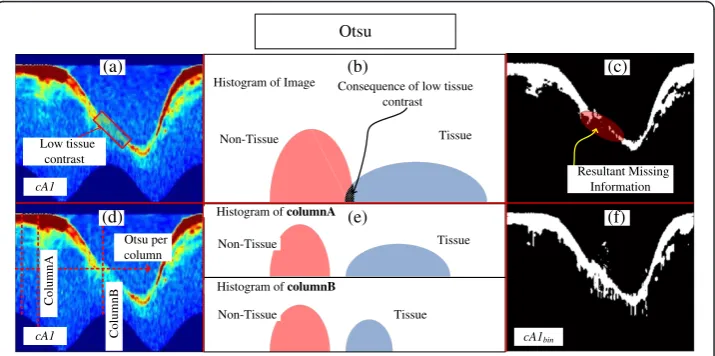 Figure 4 Steps of the DWPF stage. (a)(c) Preprocessed Image. (b) DWPF coefficients of 1st decomposition