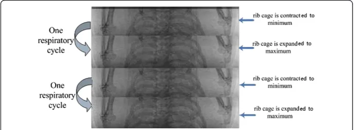Figure 2 Images of two respiratory cycles viewed from one angle.