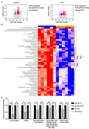 Figure 5 CS knockdown exerts the inhibitory effects on inhibits cell lipid metabolism of PCa cells