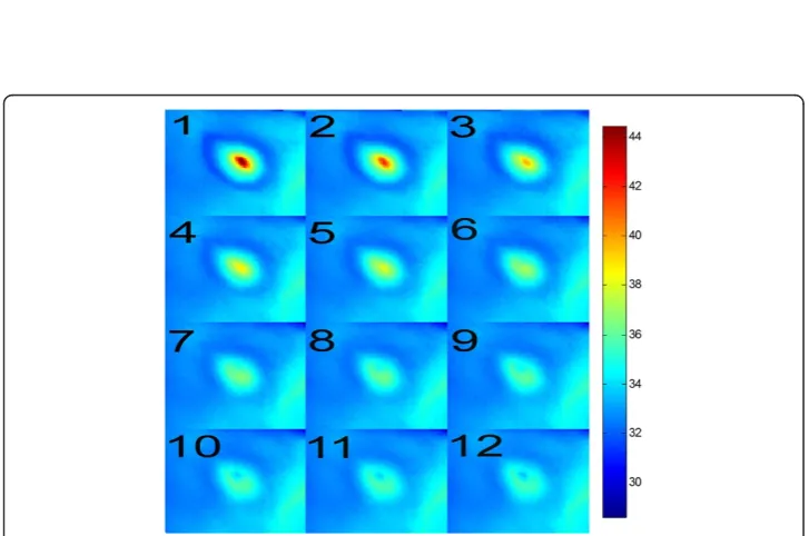 Figure 2 Patient’s skin temperature changes as function of time elapsed. Point forcing was applied (att=0) in the form of a CO2RE laser pulse