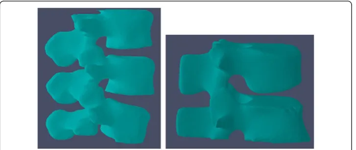 Figure 7 2D segmentation results. Columns (a) (b) (c) are segmentation results of 2D CT slices.