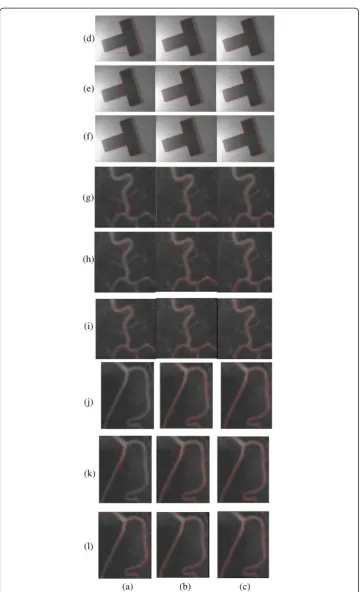 Figure 3 Illustration of segmentation procedure. (a) original image, (b) initial contours, (c) 10thiteration; (d) 30th iteration; (e) 60th iteration; (f) 100th iteration; (g) 140th iteration; (h) final segmentationresult at 180th iteration